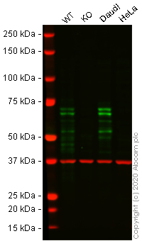 Western blot - Anti-Ikaros antibody [EPR13790] (AB191394), expandable thumbnail