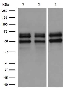 Western blot - Anti-Ikaros antibody [EPR13790] (AB191394), expandable thumbnail