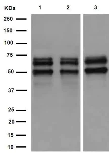 Western blot - Anti-Ikaros antibody [EPR13790] (AB191394)