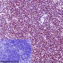 Immunohistochemistry (Formalin/PFA-fixed paraffin-embedded sections) - Anti-Ikaros antibody [EPR13790] - BSA and Azide free (AB206645)