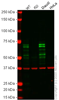 Western blot - Anti-Ikaros antibody [EPR13791] - BSA and Azide free (AB206644)
