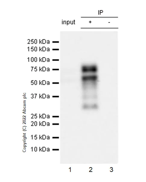 Immunoprecipitation - Anti-Ikaros antibody [EPR25259-176] (AB300405)