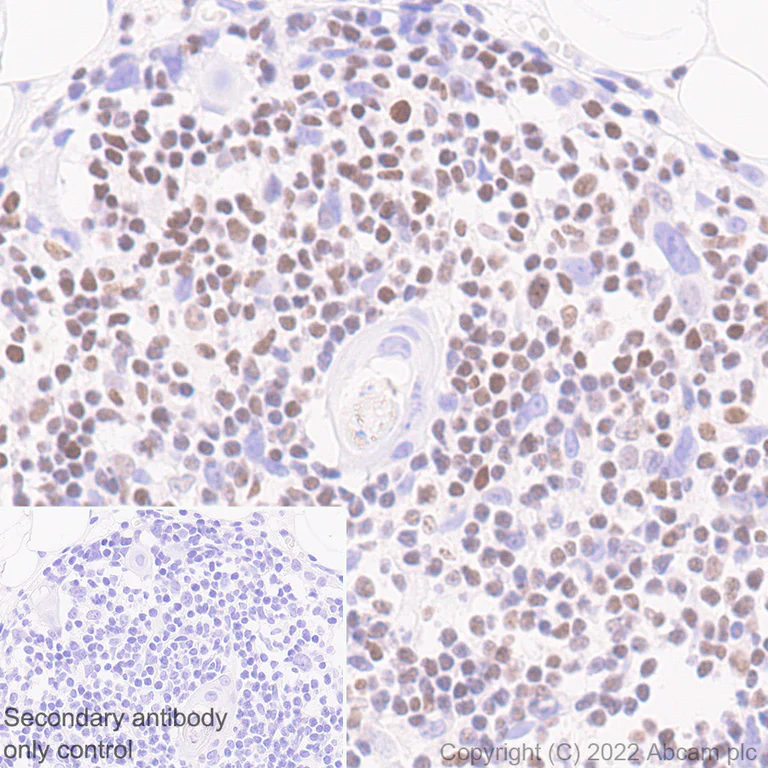 Immunohistochemistry (Formalin/PFA-fixed paraffin-embedded sections) - Anti-Ikaros antibody [EPR25259-176] (BSA and Azide free) (AB300417)