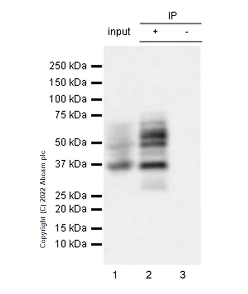 Immunoprecipitation - Anti-Ikaros antibody [EPR25259-176] (BSA and Azide free) (AB300417)