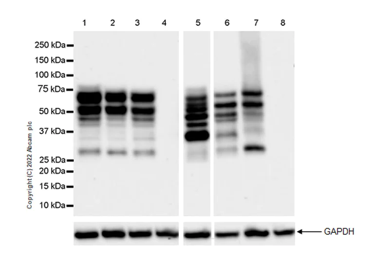 Western blot - Anti-Ikaros antibody [EPR25259-176] (BSA and Azide free) (AB300417)