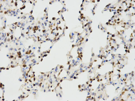 Immunohistochemistry (Formalin/PFA-fixed paraffin-embedded sections) - Anti-Ikaros antibody - N-terminal (AB180713)