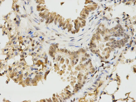 Immunohistochemistry (Formalin/PFA-fixed paraffin-embedded sections) - Anti-Ikaros antibody - N-terminal (AB180713)