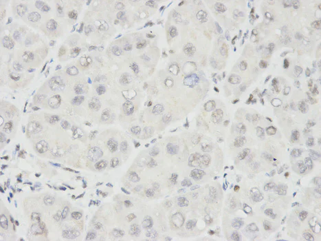 Immunohistochemistry (Formalin/PFA-fixed paraffin-embedded sections) - Anti-Ikaros antibody - N-terminal (AB180713)