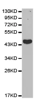 Western blot - Anti-Ikaros antibody - N-terminal (AB180713)