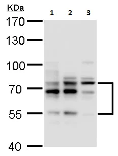 Western blot - Anti-Ikaros antibody - N-terminal (AB229275)