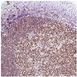 Immunohistochemistry (Formalin/PFA-fixed paraffin-embedded sections) - Anti-Ikaros antibody [SP108] (AB105228)