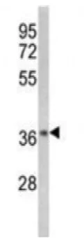 Western blot - Anti-IKB alpha antibody (AB7217)