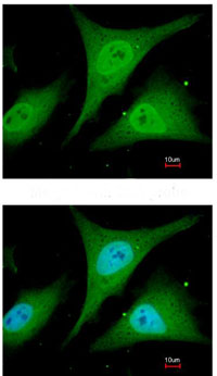 Immunocytochemistry/ Immunofluorescence - Anti-IKB alpha antibody (AB97783), expandable thumbnail