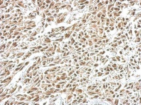 Immunohistochemistry (Formalin/PFA-fixed paraffin-embedded sections) - Anti-IKB alpha antibody (AB97783), expandable thumbnail
