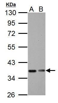 Western blot - Anti-IKB alpha antibody (AB97783), expandable thumbnail