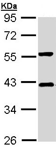 Western blot - Anti-IKB alpha antibody (AB97783), expandable thumbnail
