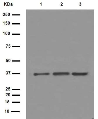 Western blot - Anti-IKB alpha antibody [E130] (AB32518)