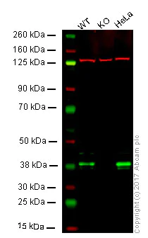 Western blot - Anti-IKB alpha antibody [E130] (AB32518)