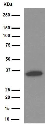 Western blot - Anti-IKB alpha antibody [E130] (AB32518)