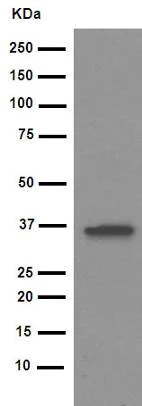Western blot - Anti-IKB alpha antibody [E130] (AB32518)