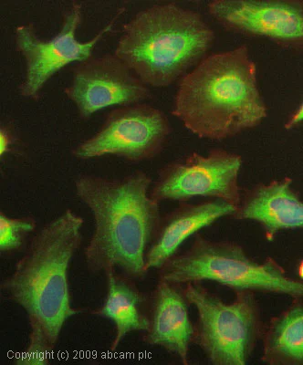 Immunocytochemistry/ Immunofluorescence - Anti-IKB alpha antibody [E130] - BSA and Azide free (AB215972)