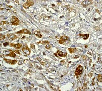 Immunohistochemistry (Formalin/PFA-fixed paraffin-embedded sections) - Anti-IKB alpha antibody [E130] - BSA and Azide free (AB215972)