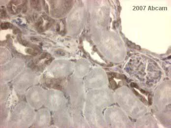 Immunohistochemistry (Formalin/PFA-fixed paraffin-embedded sections) - Anti-IKB alpha antibody [E130] - BSA and Azide free (AB215972)