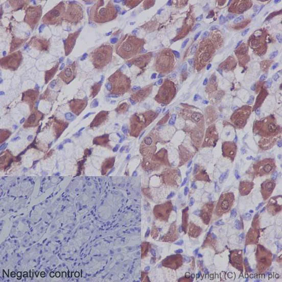 Immunohistochemistry (Formalin/PFA-fixed paraffin-embedded sections) - Anti-IKB alpha antibody [E130] - BSA and Azide free (AB215972)