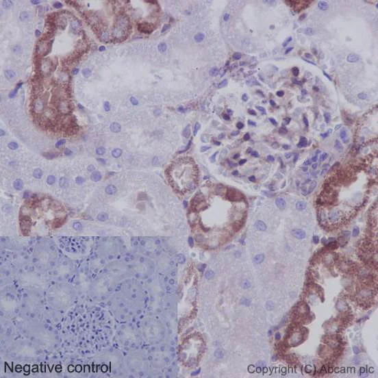 Immunohistochemistry (Formalin/PFA-fixed paraffin-embedded sections) - Anti-IKB alpha antibody [E130] - BSA and Azide free (AB215972)