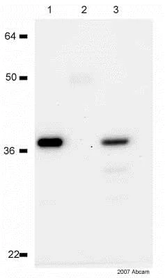 Immunoprecipitation - Anti-IKB alpha antibody [E130] - BSA and Azide free (AB215972)