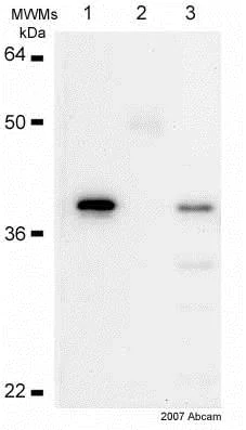 Immunoprecipitation - Anti-IKB alpha antibody [E130] - BSA and Azide free (AB215972)