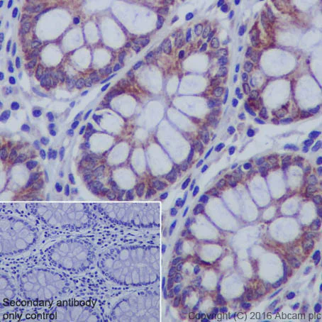 Immunohistochemistry (Formalin/PFA-fixed paraffin-embedded sections) - Anti-IKB alpha antibody [EP697] (AB76429)