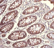 Immunohistochemistry (Formalin/PFA-fixed paraffin-embedded sections) - Anti-IKB alpha antibody [EP697] (AB76429)