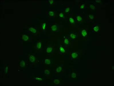 Immunocytochemistry/ Immunofluorescence - Anti-IKB alpha (phospho S32) antibody [2D6] (AB314031)
