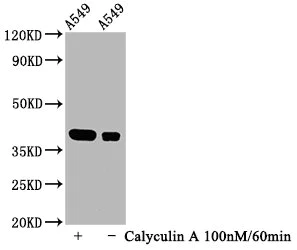 Western blot - Anti-IKB alpha (phospho S32) antibody [2D6] (AB314031)