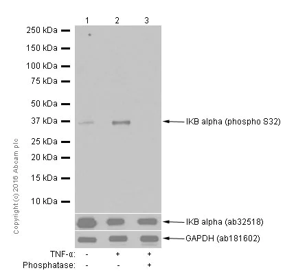 Western blot - Anti-IKB alpha (phospho S32) antibody [EPR3148] (AB92700)