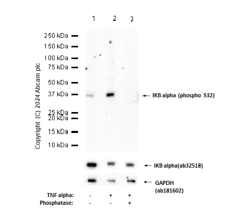 Western blot - Anti-IKB alpha (phospho S32) antibody [EPR3148] (AB92700)