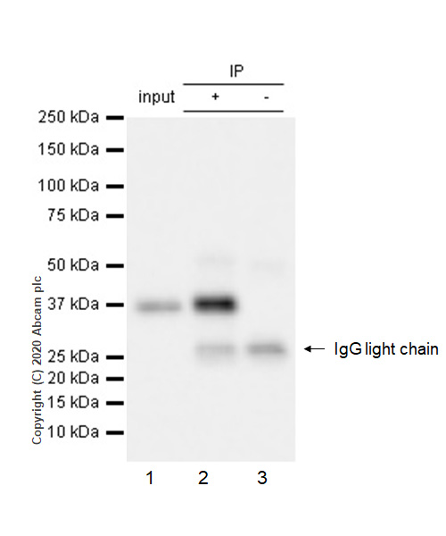 Immunoprecipitation - Anti-IKB alpha (phospho S32) antibody [EPR3148] - BSA and Azide free (AB239920), expandable thumbnail