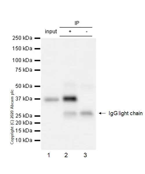 Immunoprecipitation - Anti-IKB alpha (phospho S32) antibody [EPR3148] - BSA and Azide free (AB239920)