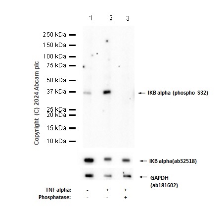 Western blot - Anti-IKB alpha (phospho S32) antibody [EPR3148] - BSA and Azide free (ab239920), expandable thumbnail