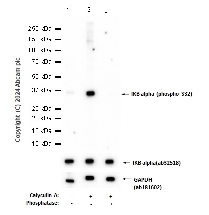 Western blot - Anti-IKB alpha (phospho S32) antibody [EPR3148] - BSA and Azide free (AB239920), expandable thumbnail