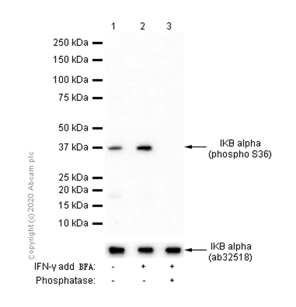 Western blot - Anti-IKB alpha (phospho S36) antibody [EPR6235(2)] - BSA and Azide free (AB240059)