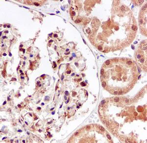 Immunohistochemistry (Formalin/PFA-fixed paraffin-embedded sections) - Anti-IKB beta antibody [EPR5037] (AB109509)