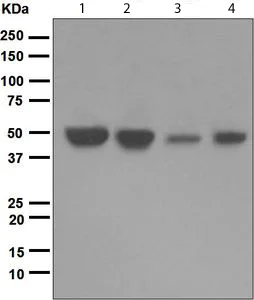 Western blot - Anti-IKB beta antibody [EPR5037] (AB109509)