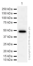 Western blot - Anti-IKB beta antibody [EPR5037] (AB109509)