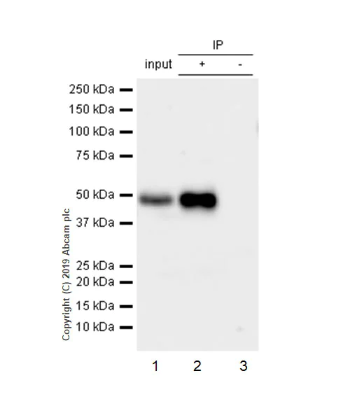Immunoprecipitation - Anti-IKB beta antibody [EPR5037] - BSA and Azide free (AB247886)