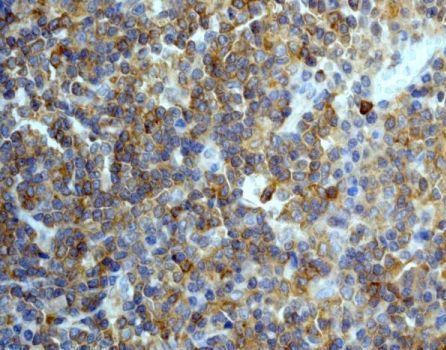 Immunohistochemistry (Formalin/PFA-fixed paraffin-embedded sections) - Anti-IKB epsilon antibody [EPR901(2)] (AB134143), expandable thumbnail