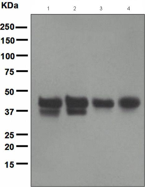 Western blot - Anti-IKB epsilon antibody [EPR901(2)] (AB134143), expandable thumbnail