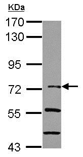 Western blot - Anti-IKB zeta antibody (AB155142), expandable thumbnail