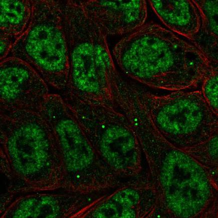 Immunocytochemistry/ Immunofluorescence - Anti-IKB zeta antibody (AB221914)